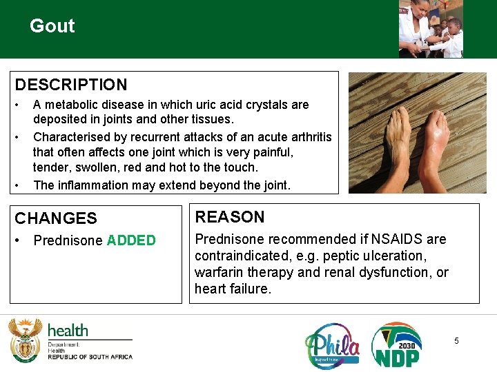 Gout DESCRIPTION • • • A metabolic disease in which uric acid crystals are