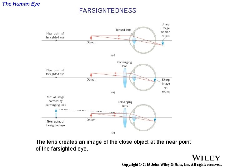 The Human Eye FARSIGNTEDNESS The lens creates an image of the close object at