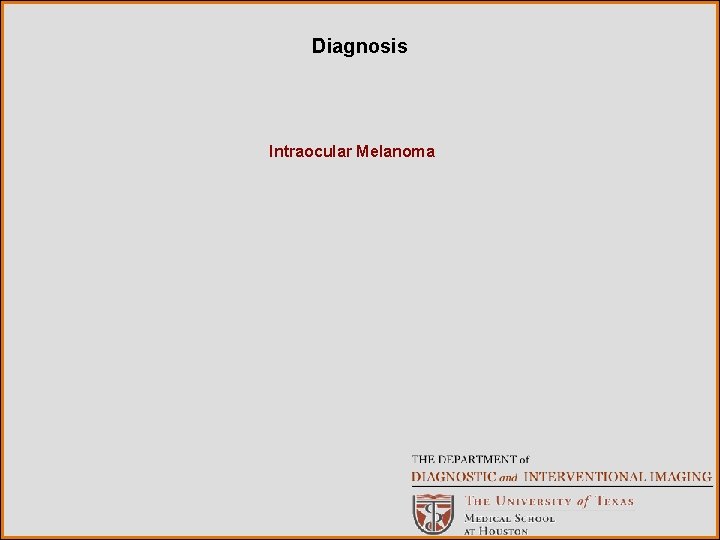 Diagnosis Intraocular Melanoma 