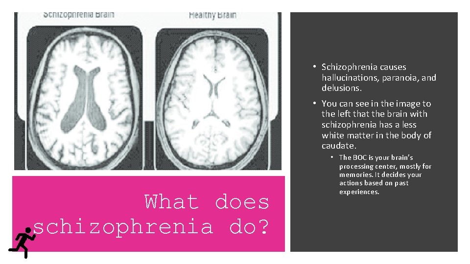  • Schizophrenia causes hallucinations, paranoia, and delusions. • You can see in the