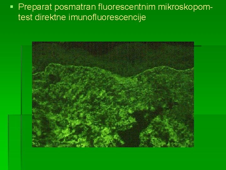 § Preparat posmatran fluorescentnim mikroskopomtest direktne imunofluorescencije 