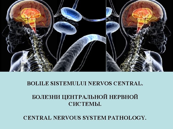 BOLILE SISTEMULUI NERVOS CENTRAL. БОЛЕЗНИ ЦЕНТРАЛЬНОЙ НЕРВНОЙ СИСТЕМЫ. CENTRAL NERVOUS SYSTEM PATHOLOGY. 