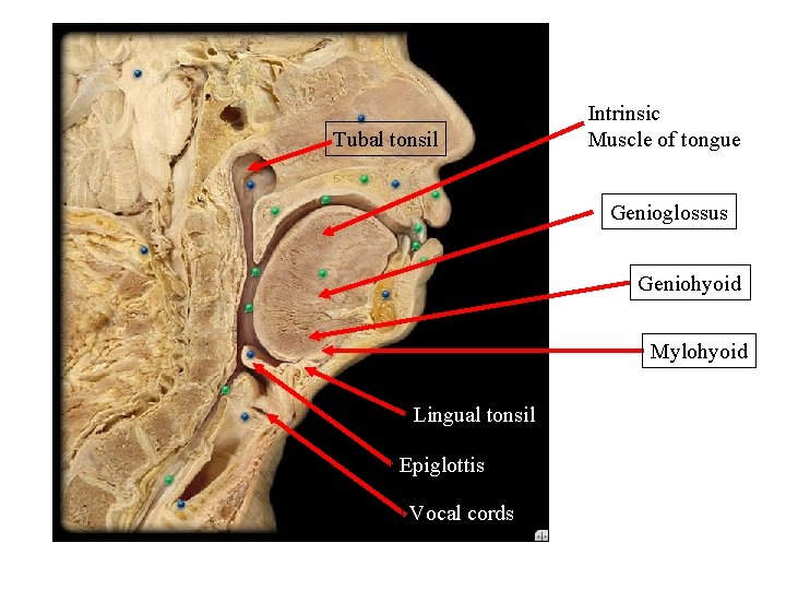 Tubal tonsil Intrinsic Muscle of tongue Genioglossus Geniohyoid Mylohyoid Lingual tonsil Epiglottis Vocal cords