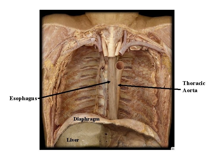 Thoracic Aorta Esophagus Diaphragm Liver 