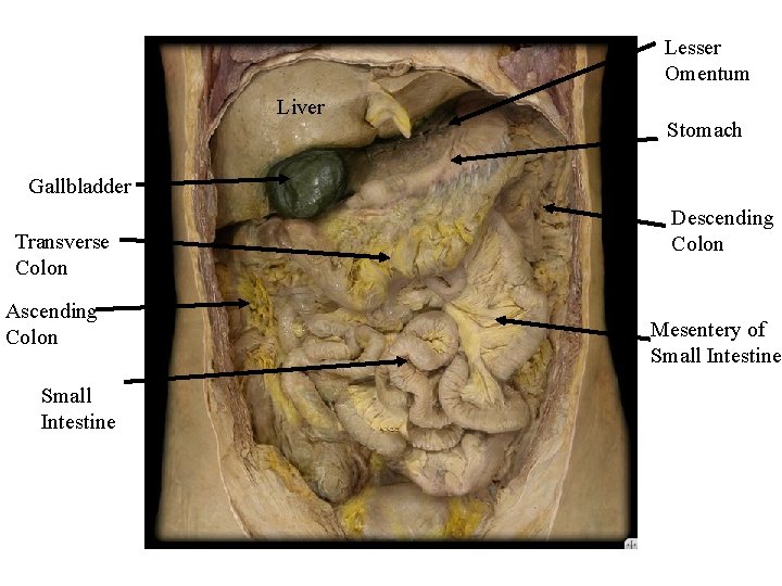 Lesser Omentum Liver Stomach Gallbladder Transverse Colon Ascending Colon Small Intestine Descending Colon Mesentery