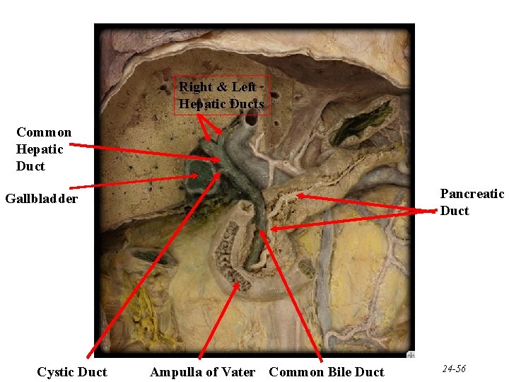 Right & Left Hepatic Ducts Common Hepatic Duct Pancreatic Duct Gallbladder Cystic Duct Ampulla