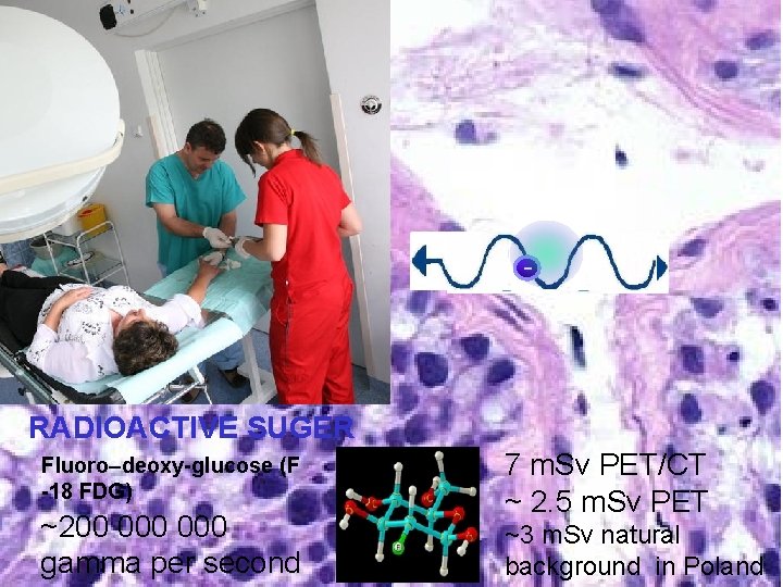 - RADIOACTIVE SUGER Fluoro–deoxy-glucose (F -18 FDG) ~200 000 gamma per second 7 m.