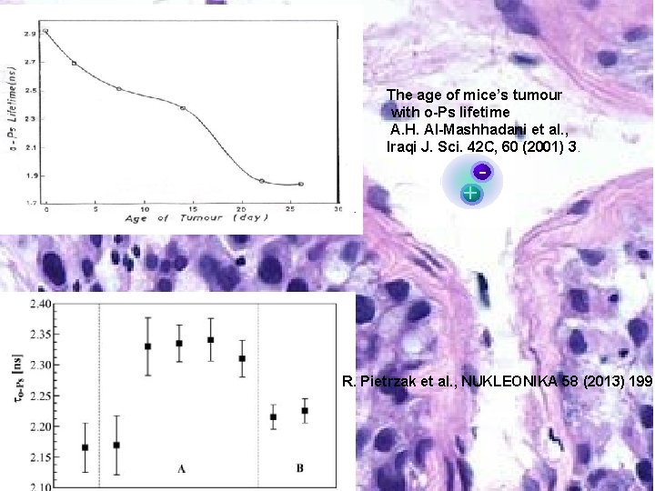 The age of mice’s tumour with o-Ps lifetime A. H. Al-Mashhadani et al. ,