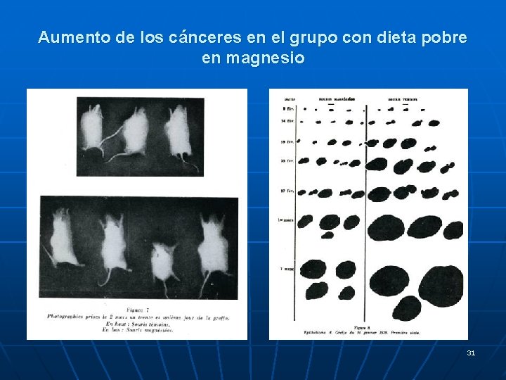 Aumento de los cánceres en el grupo con dieta pobre en magnesio 31 Aumento de los cánceres en el grupo con dieta pobre en magnesio 31