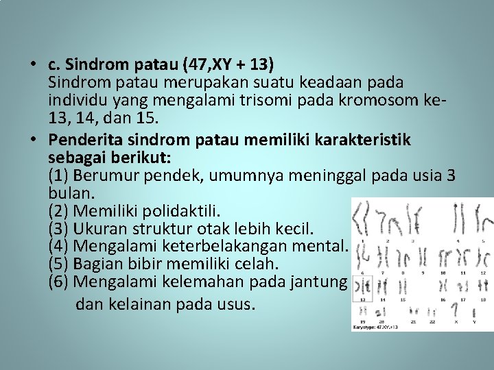  • c. Sindrom patau (47, XY + 13) Sindrom patau merupakan suatu keadaan