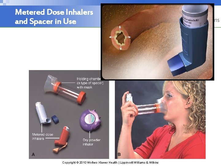 Metered Dose Inhalers and Spacer in Use Copyright © 2010 Wolters Kluwer Health |