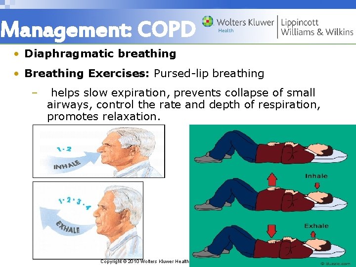 Management: COPD • Diaphragmatic breathing • Breathing Exercises: Pursed-lip breathing – helps slow expiration,