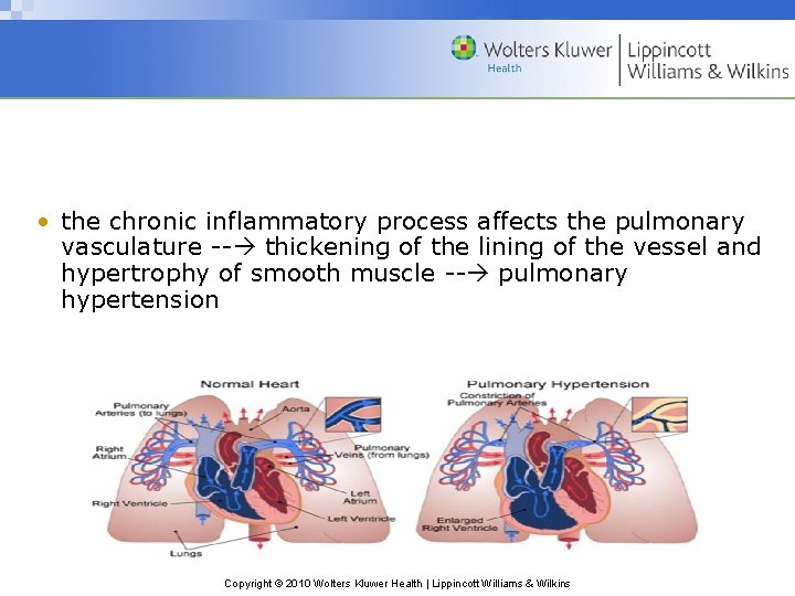  • the chronic inflammatory process affects the pulmonary vasculature -- thickening of the