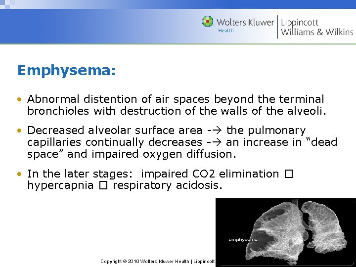 Emphysema: • Abnormal distention of air spaces beyond the terminal bronchioles with destruction of
