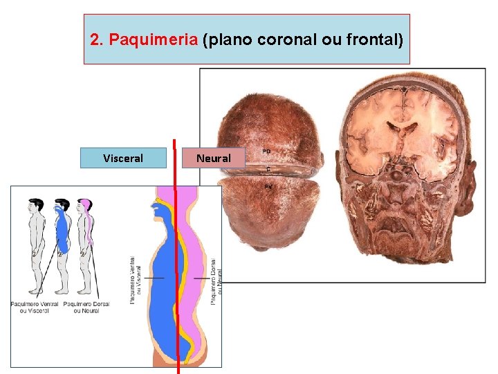 2. Paquimeria (plano coronal ou frontal) Visceral Neural 