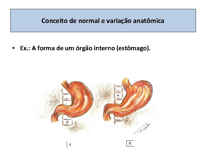 Conceito de normal e variação anatômica • Ex. : A forma de um órgão