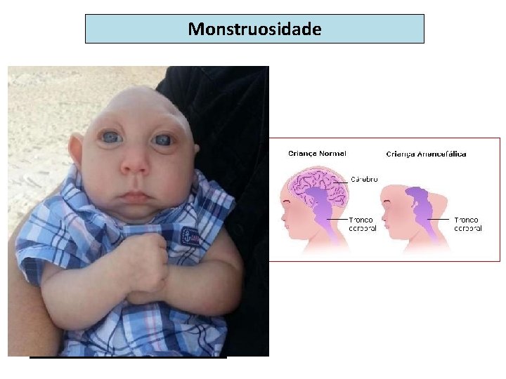 Monstruosidade 