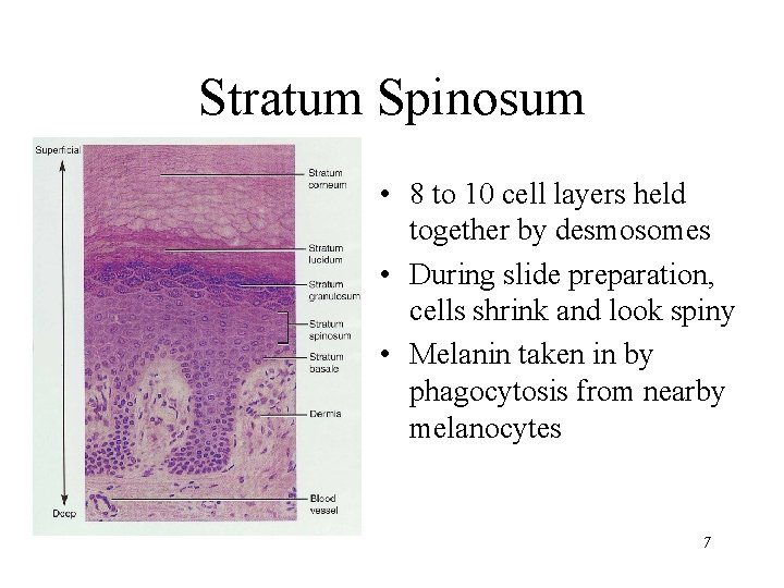 Stratum Spinosum • 8 to 10 cell layers held together by desmosomes • During