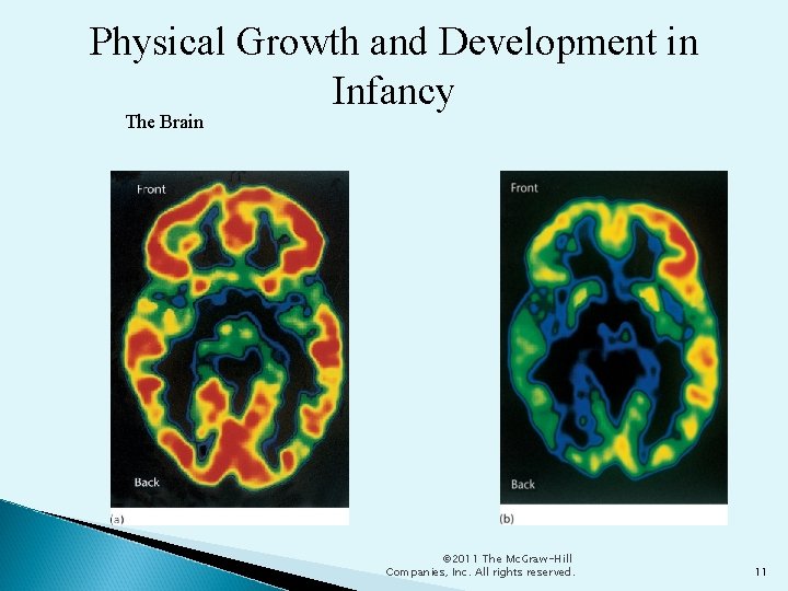 Physical Growth and Development in Infancy The Brain © 2011 The Mc. Graw-Hill Companies,
