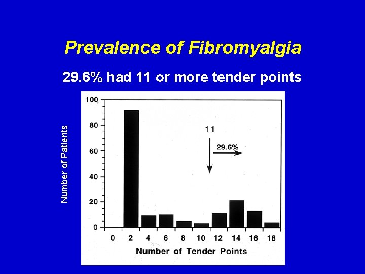 Prevalence of Fibromyalgia Number of Patients 29. 6% had 11 or more tender points