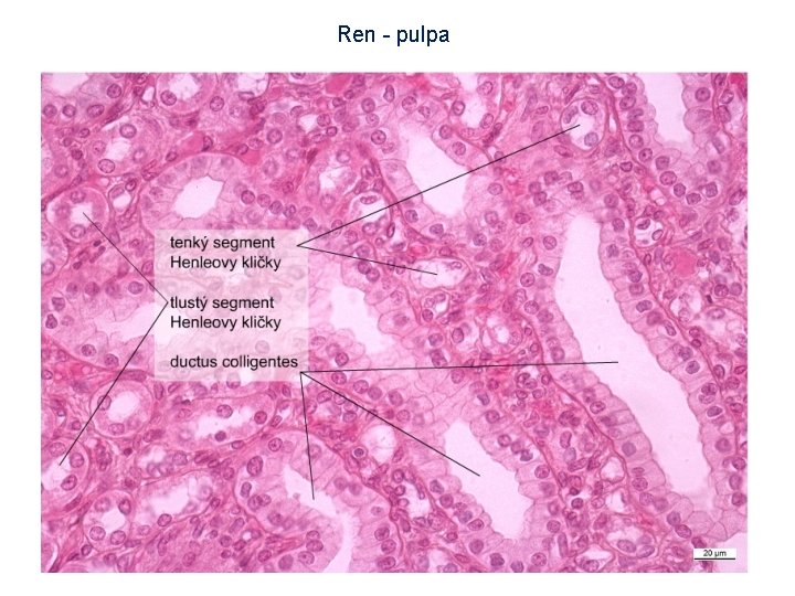 Ren - pulpa 10 