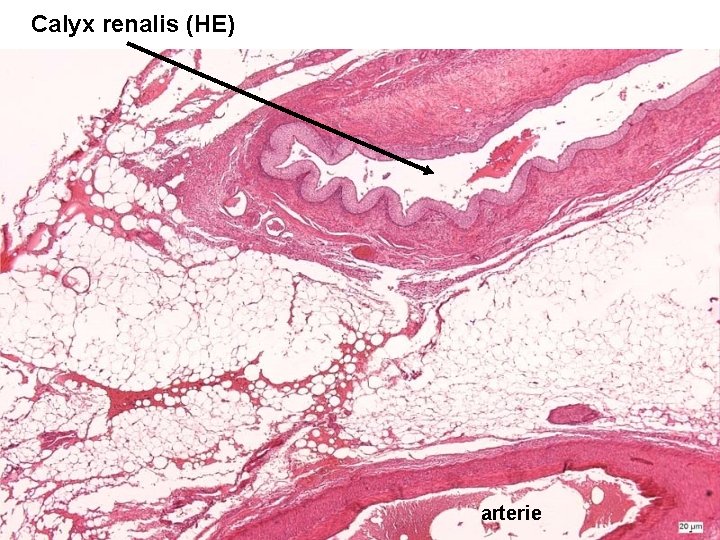 Calyx renalis (HE) arterie 13 