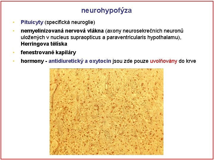 neurohypofýza • Pituicyty (specifická neuroglie) • nemyelinizovaná nervová vlákna (axony neurosekrečních neuronů uložených v