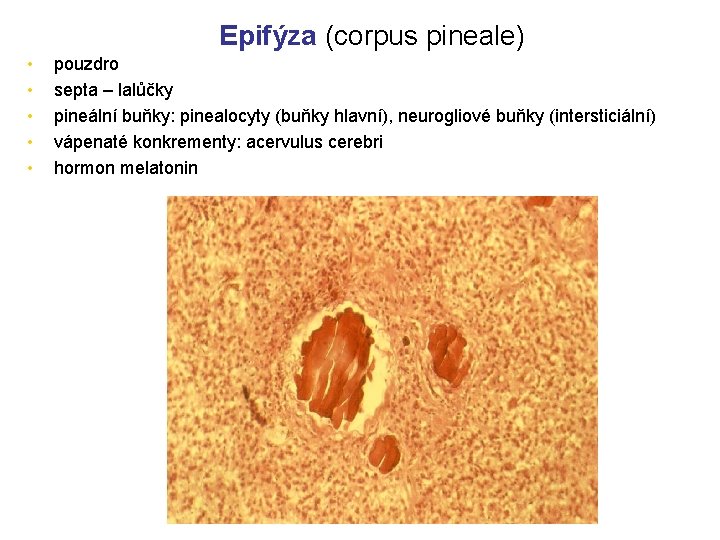 Epifýza (corpus pineale) • • • pouzdro septa – lalůčky pineální buňky: pinealocyty (buňky