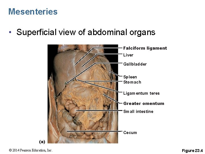 Mesenteries • Superficial view of abdominal organs Falciform ligament Liver Gallbladder Spleen Stomach Ligamentum
