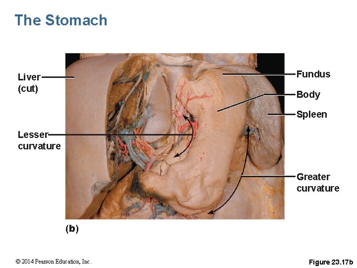 The Stomach Fundus Liver (cut) Body Spleen Lesser curvature Greater curvature (b) © 2014
