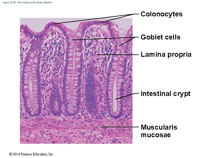 Figure 23. 23 The mucosa of the large intestine. Colonocytes Goblet cells Lamina propria