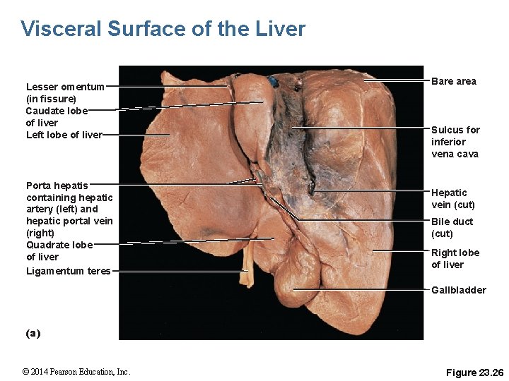 Visceral Surface of the Liver Lesser omentum (in fissure) Caudate lobe of liver Left