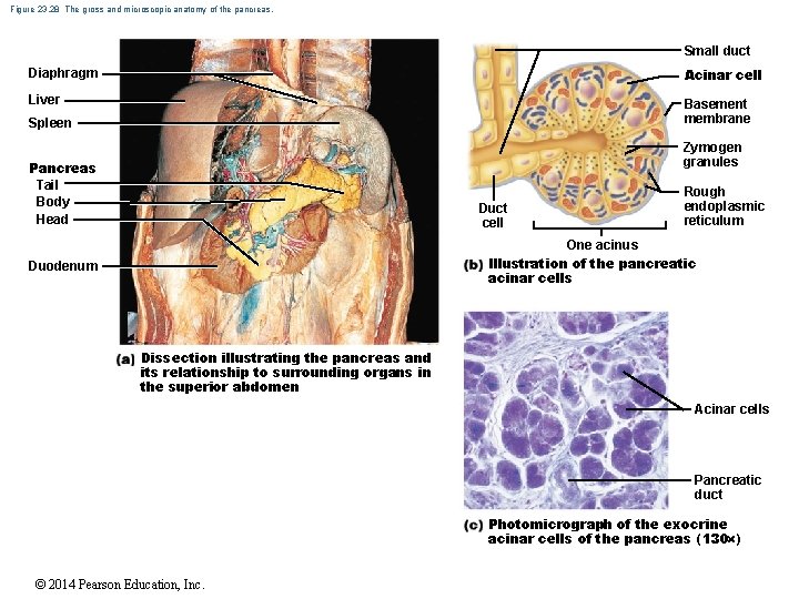 Figure 23. 28 The gross and microscopic anatomy of the pancreas. Small duct Diaphragm