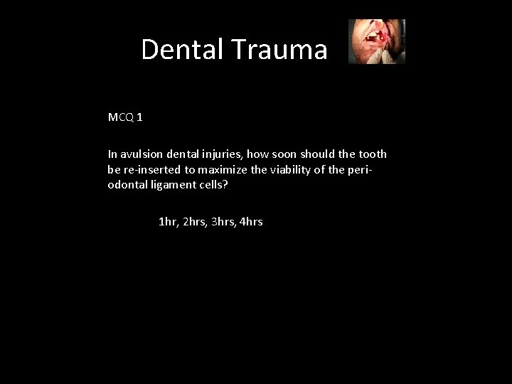 Dental Trauma MCQ 1 In avulsion dental injuries, how soon should the tooth be