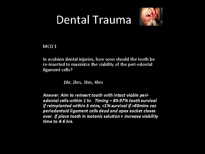 Dental Trauma MCQ 1 In avulsion dental injuries, how soon should the tooth be