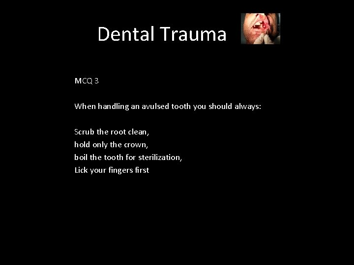 Dental Trauma MCQ 3 When handling an avulsed tooth you should always: Scrub the