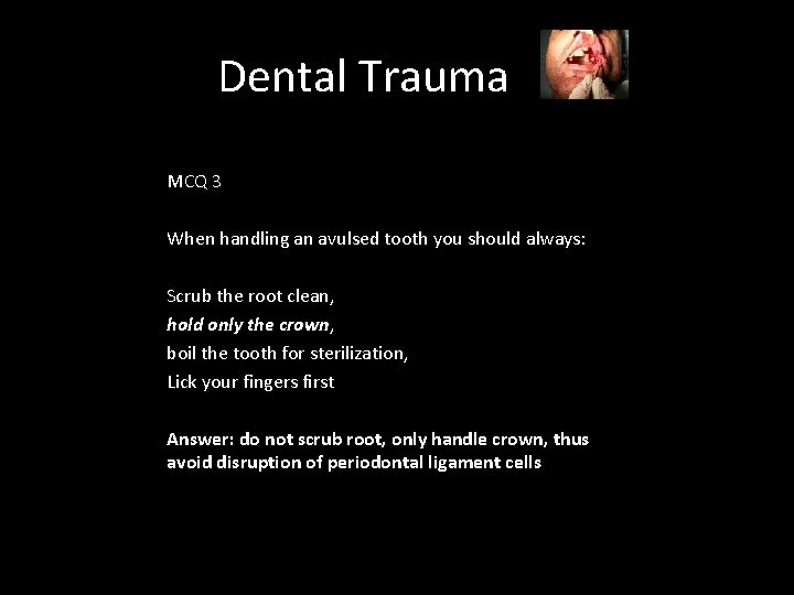 Dental Trauma MCQ 3 When handling an avulsed tooth you should always: Scrub the