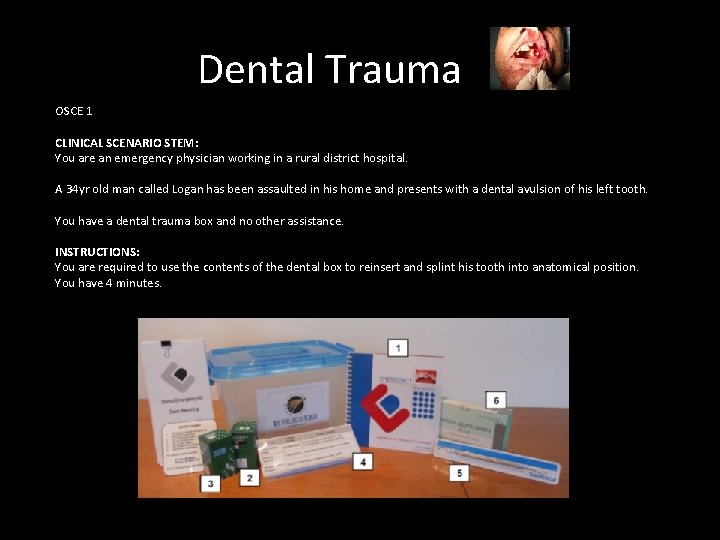 Dental Trauma OSCE 1 CLINICAL SCENARIO STEM: You are an emergency physician working in