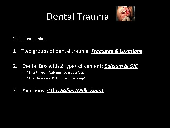 Dental Trauma 3 take home points 1. Two groups of dental trauma: Fractures &