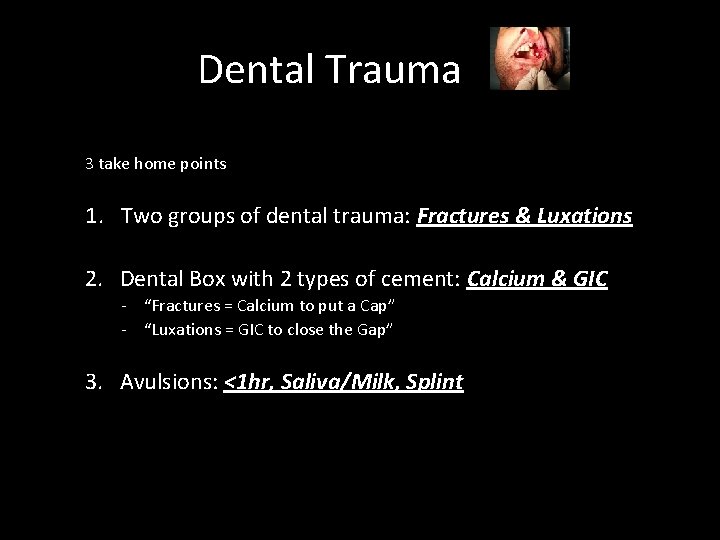 Dental Trauma 3 take home points 1. Two groups of dental trauma: Fractures &