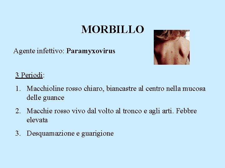 MORBILLO Agente infettivo: Paramyxovirus 3 Periodi: 1. Macchioline rosso chiaro, biancastre al centro nella