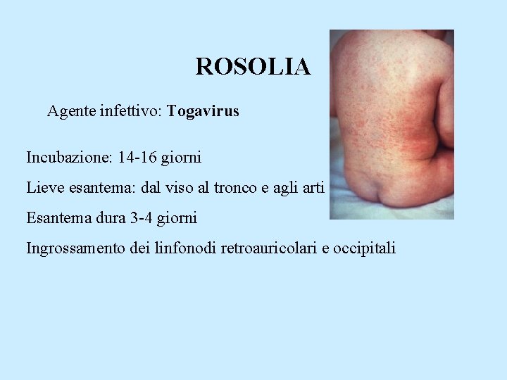 ROSOLIA Agente infettivo: Togavirus Incubazione: 14 -16 giorni Lieve esantema: dal viso al tronco