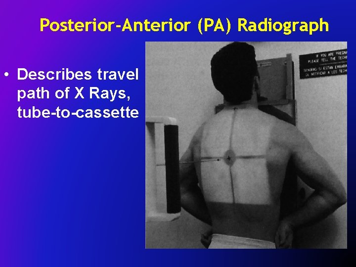 Posterior-Anterior (PA) Radiograph • Describes travel path of X Rays, tube-to-cassette 