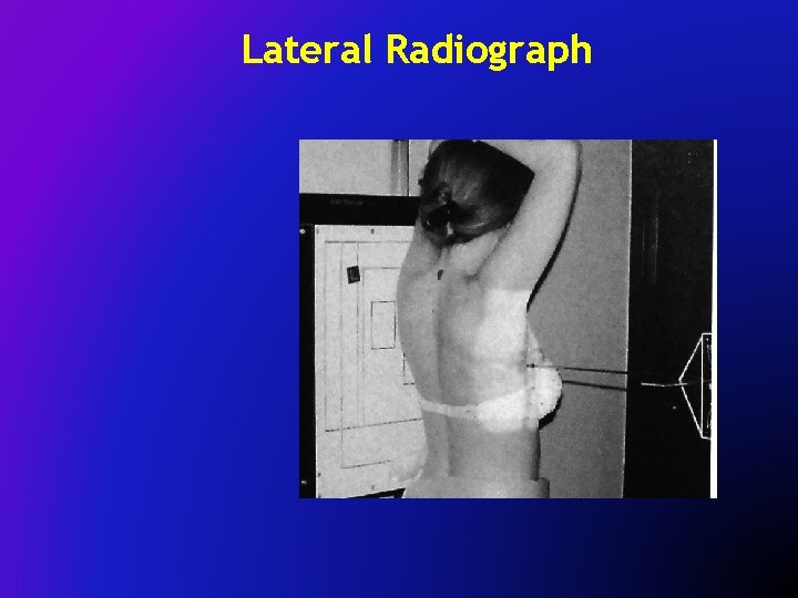 Lateral Radiograph 