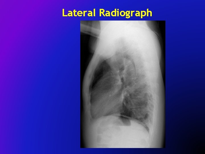 Lateral Radiograph 