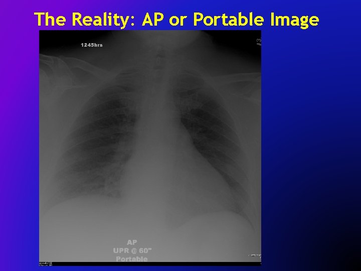 The Reality: AP or Portable Image 