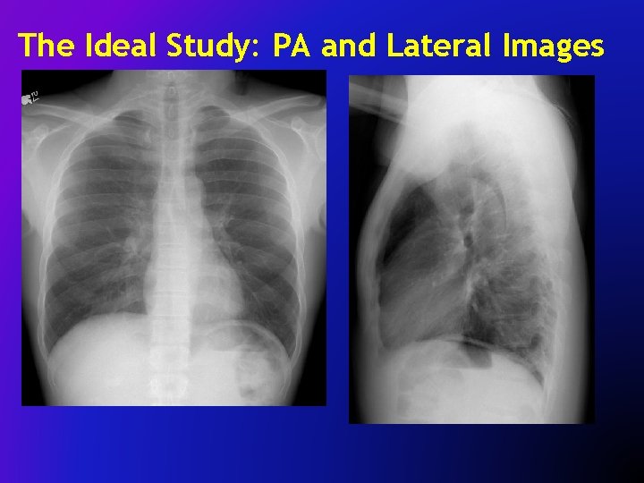 The Ideal Study: PA and Lateral Images 