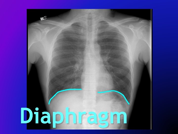 Diaphragm 