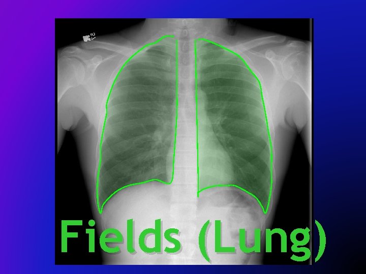 Fields (Lung) 