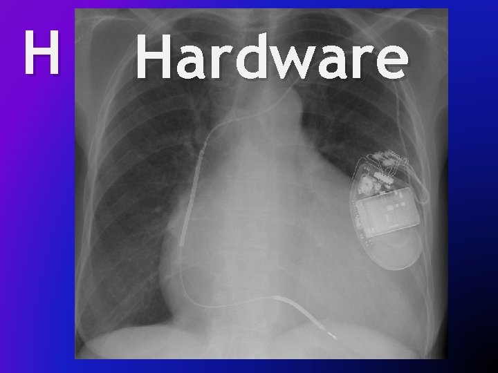 H Hardware 